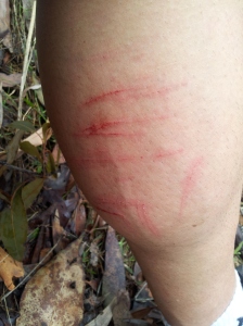 Geocaching scratches on my calf